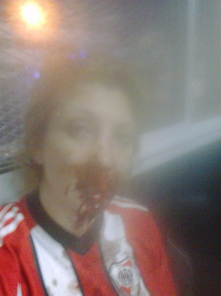 Illustration for article titled Argentine Woman Says She Was Brutally Beaten For Wearing Soccer Jersey